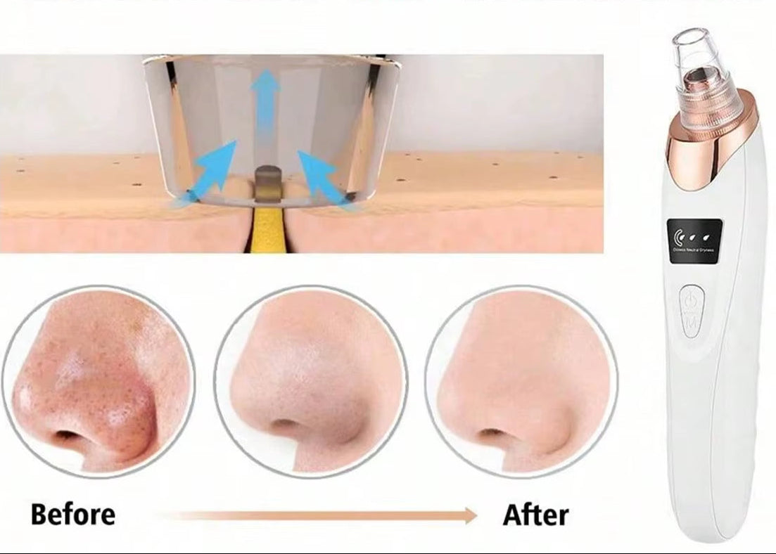 2026 Facial Pore Cleaner, 5 Suction Power Blackhead Remover Pore Vacuum - USB Rechargeable Facial Pore Cleaner Kit
